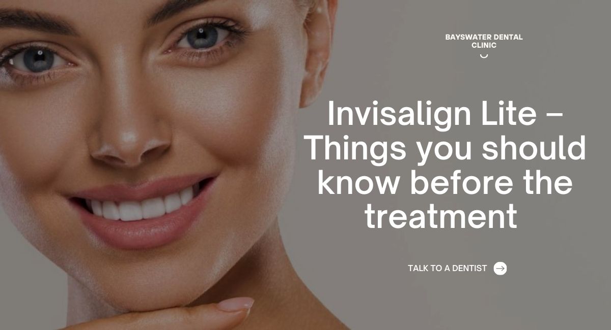 Invisalign-Lite