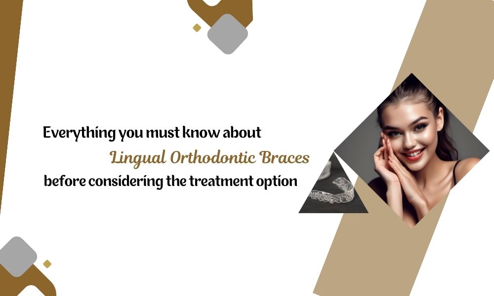 Everything-you-must-know-about-lingual-orthodontic-braces-before-considering-the-treatment-option