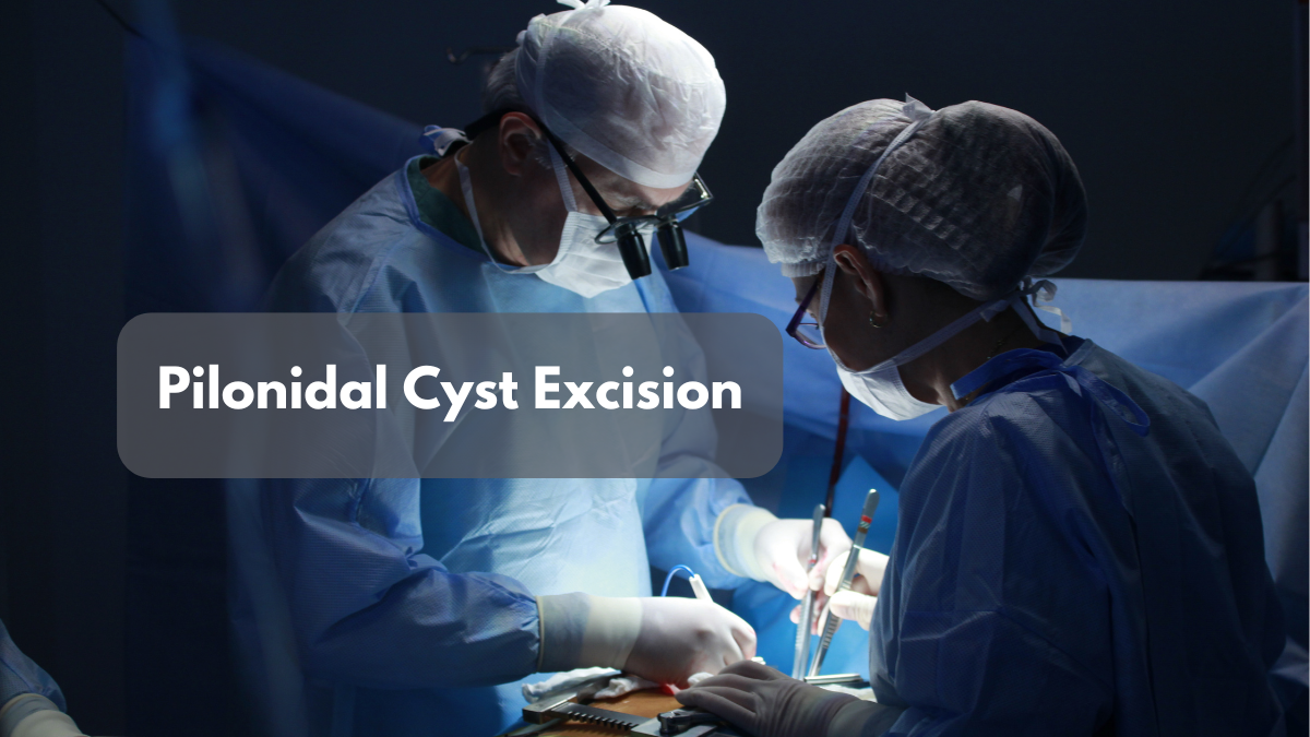 pilonidal cyst excision