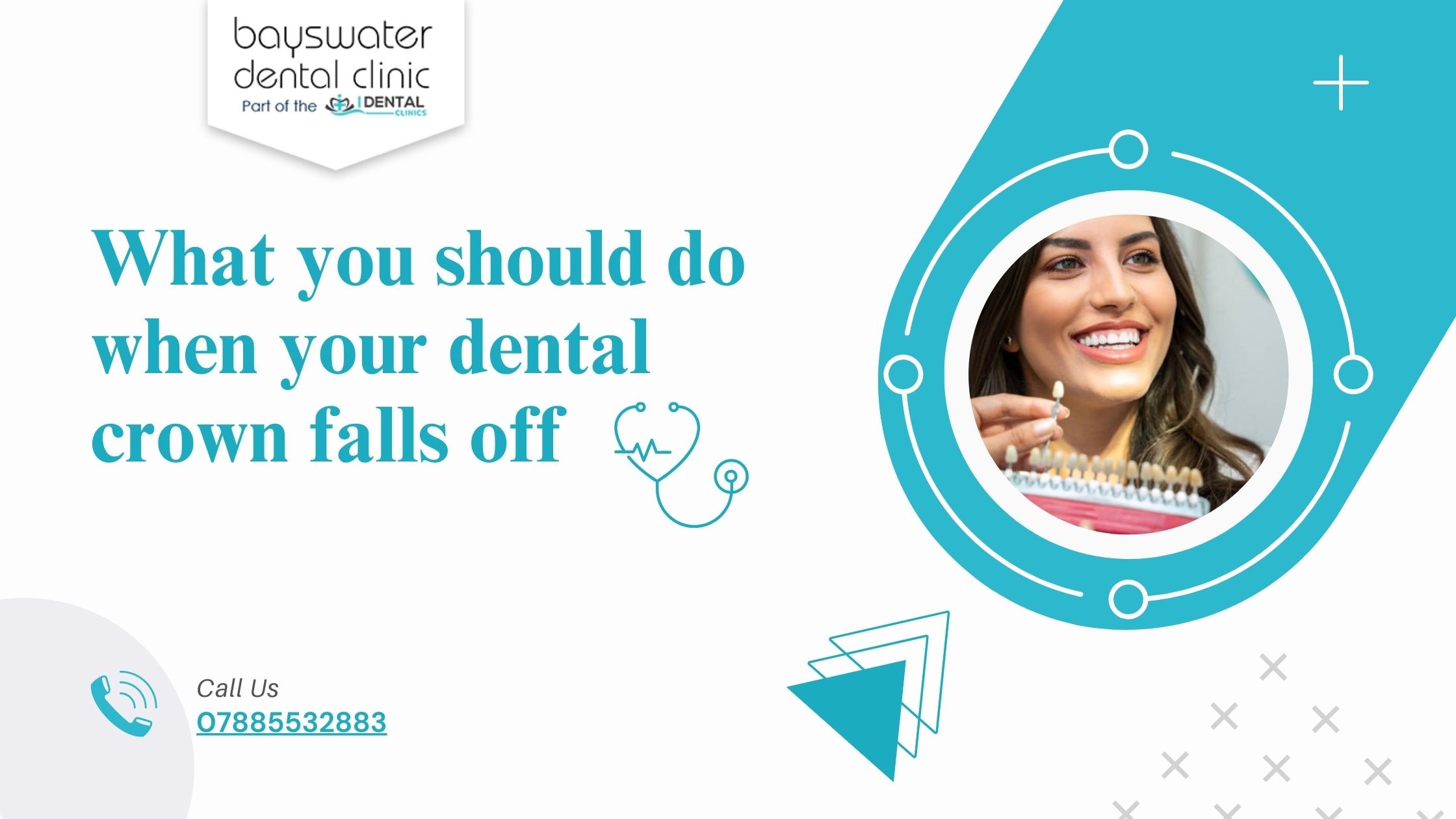 What-you-should-do-when-your-dental-crown-falls-off